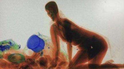 智能安檢機呈現(xiàn)人形圖像